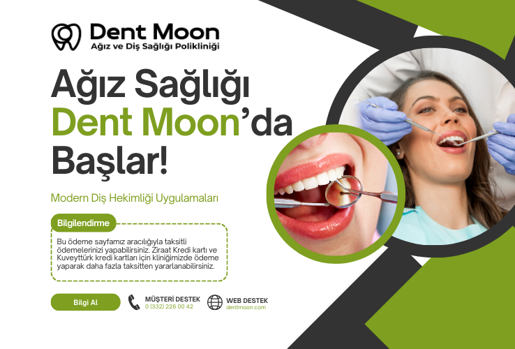 Dent Moon Ödeme Sayfası